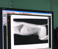 Digital Xray